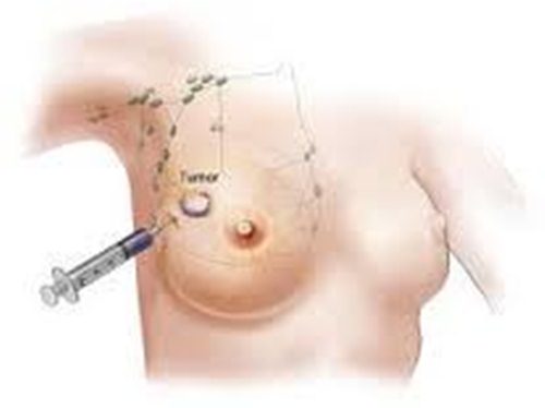 Info pengobatan kanker payudara, obat kanker payudara herbal murah, mengobati kanker payudara dengan obat tradisional, cara mengobati gejala kanker payudara secara alami, kanker payudara yg pecah, kanker payudara herbal, cara alami menyembuhkan penyakit kanker payudara, kanker payudara wikipedia bahasa indonesia, cara mengobati kanker payudara stadium 2, ramuan herbal penyakit kanker payudara, pengobatan kanker payudara terkini, ciri kanker payudara stadium 3, obat kangker payudara paling ampuh