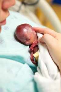 Les parents de Walter, Lexi et Joshua Fretz, parents de deux petites filles (qui ont accueilli leur troisième sœur, Mia, en septembre dernier) attendaient avec impatience l’arrivée de leur nouveau bébé lorsque, comme elle le raconte sur son blog, Lexi a expérimenté des saignements. Ce n’était pas inhabituel pour elle durant une grossesse, mais quand les saignements sont devenus roses, elle a commencé à s’inquiéter et a appelé sa sage-femme, qui lui a recommandé de se rendre aux urgences.