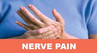 nerve pain