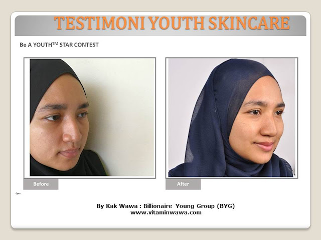 34 Testimoni Youth Skincare Shaklee Terbaru, Youth skincare shaklee, testimoni youth skincare shaklee, Youth Skincare Shaklee : Harga dan Review Pengguna Youth Shaklee, testimoni youth skincare shaklee, testimoni youth skincare shaklee 34 Testimoni Youth Skincare Shaklee Terbaru, Youth skincare shaklee, testimoni youth skincare shaklee, Youth Skincare Shaklee : Harga dan Review Pengguna Youth Shaklee, testimoni youth skincare shaklee, testimoni youth skincare shaklee
