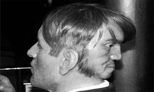 El extraño caso de Edward Mordrake el hombre que tenía dos caras El extraño caso de Edward Mordrake el hombre que tenía dos caras