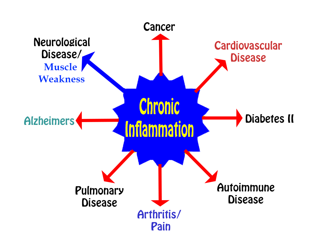 Dr. Scott Cuthbert Applied Kinesiology management of inflammatory pain
