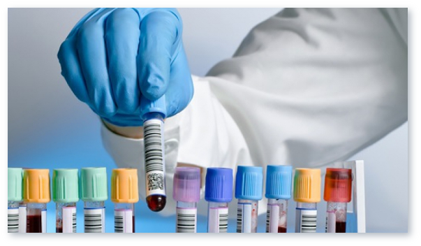 Analizele de sange. La ce interval trebuie repetate analizele de sange? Cat de importante sunt analizele de sange?