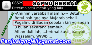 Cara Menyembuhkan Keseleo Yang Tak Kunjung Sembuh Cara Menyembuhkan Keseleo Yang Tak Kunjung Sembuh