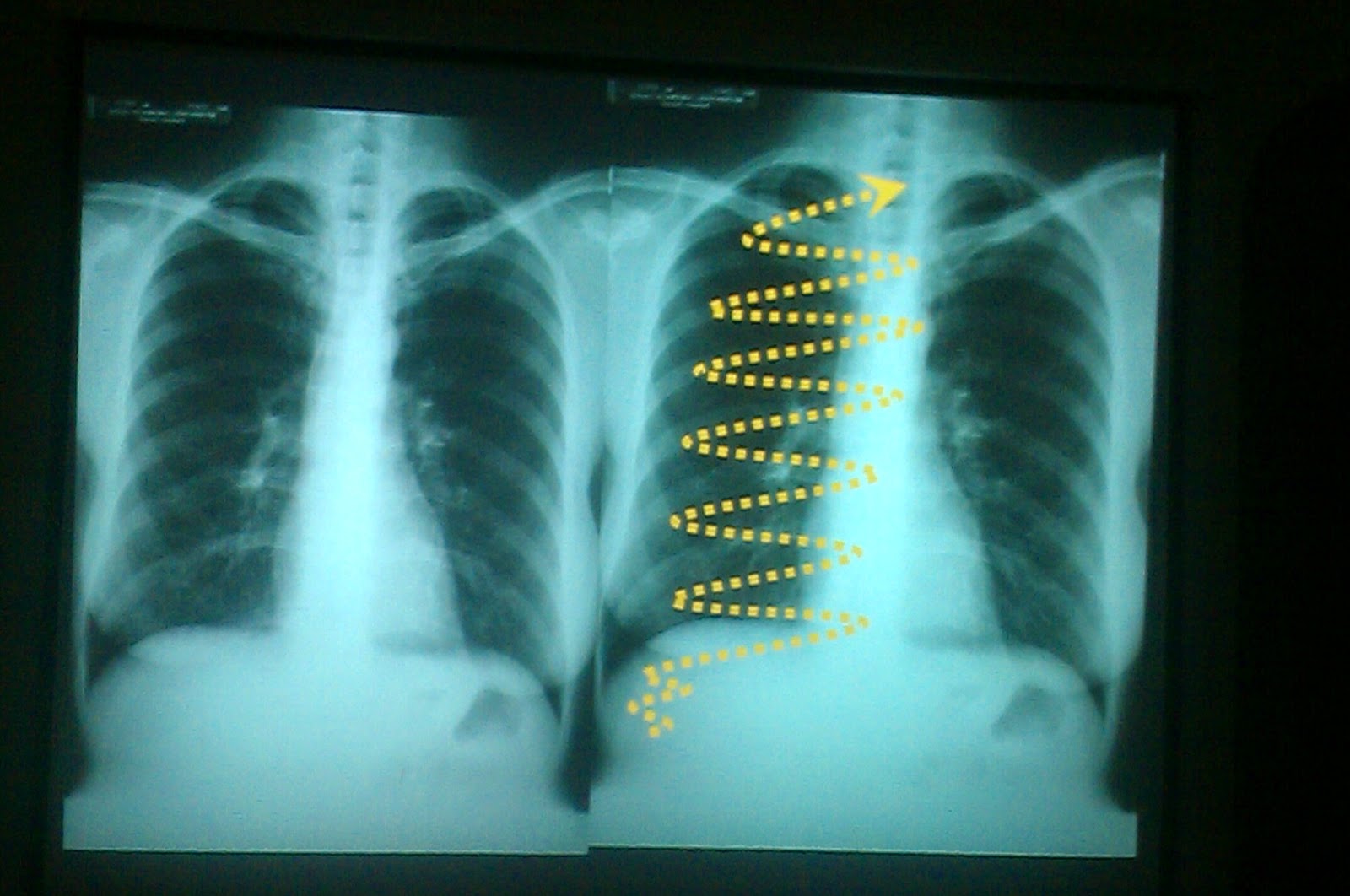 Lecture slides Radiology Chest X ray