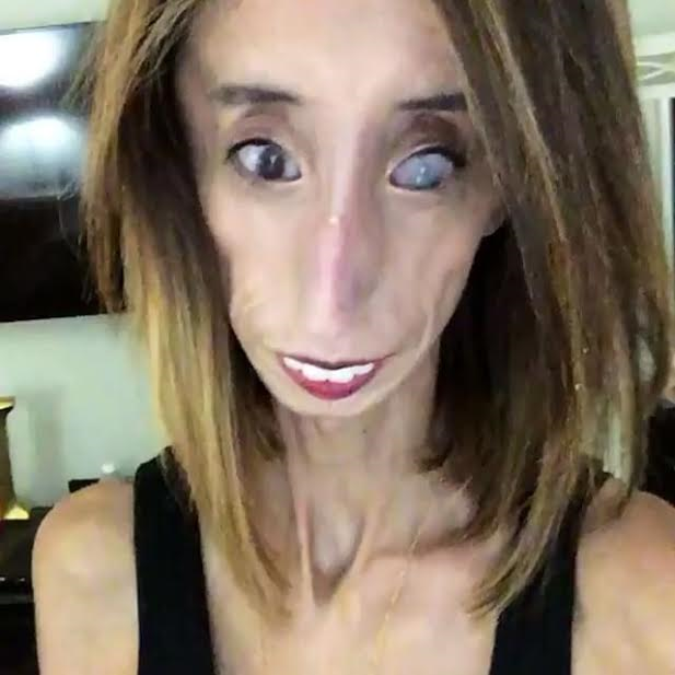 The World's Ugliest Woman Lizzie Velasquez is fighting back...in a dif...
