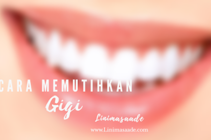 Cara memutihkan Gigi secara alami tanpa efek samping