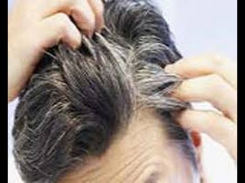 Kamal Ki Tips Beauty Tips In Hindi White Hair Solution In Hindi