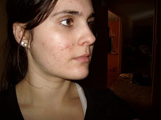 Priligy vaistai