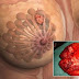 We Drink It Daily, But Don’t Know That It Causes Breast Cancer