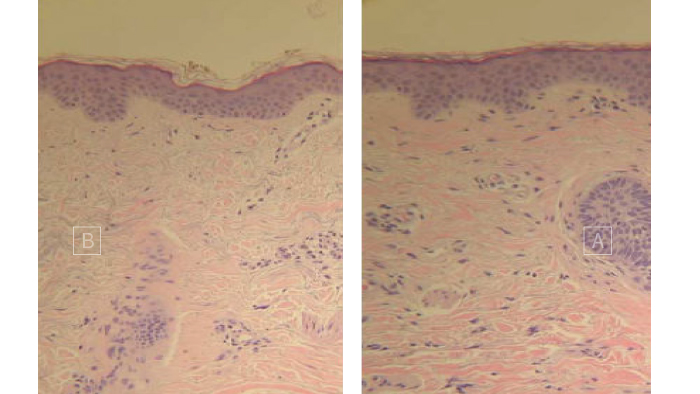 水飛梭價位水飛梭價錢飛梭新竹水飛梭費用水飛梭推薦水飛梭價格水飛梭皮膚健康管理系統水飛梭新竹推薦痘痘肌敏弱肌雷射術後林亮辰皮膚專科診所林亮辰醫師 水飛梭價位水飛梭價錢飛梭新竹水飛梭費用水飛梭推薦水飛梭價格水飛梭皮膚健康管理系統水飛梭新竹推薦痘痘肌敏弱肌雷射術後林亮辰皮膚專科診所林亮辰醫師