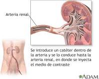 arteria renal