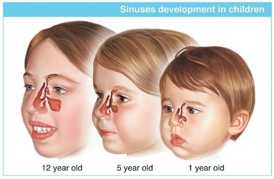 Baby Sinus Development: What You Need to Know