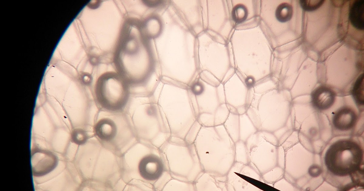 LAPORAN PENGAMATAN SEL BAWANG, SEL BATANG SINGKONG DAN SEL EPITEL EF