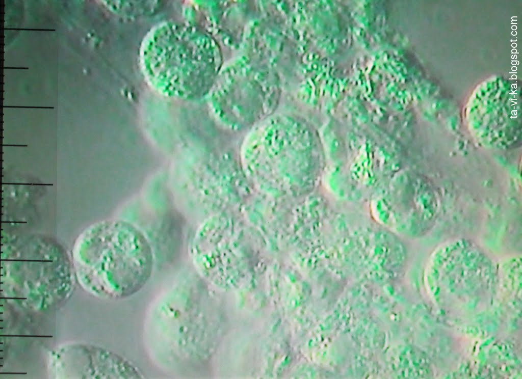Бактерии в слюне. Слюна под микроскопом. Бактерии в слюне под микроскопом. Слюна человека под микроскопом. Клетки слюны под микроскопом.