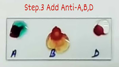 Blood-group-anti-abd