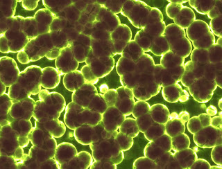 Combatendo as superbactérias com nanotecnologia e pontos quanticos