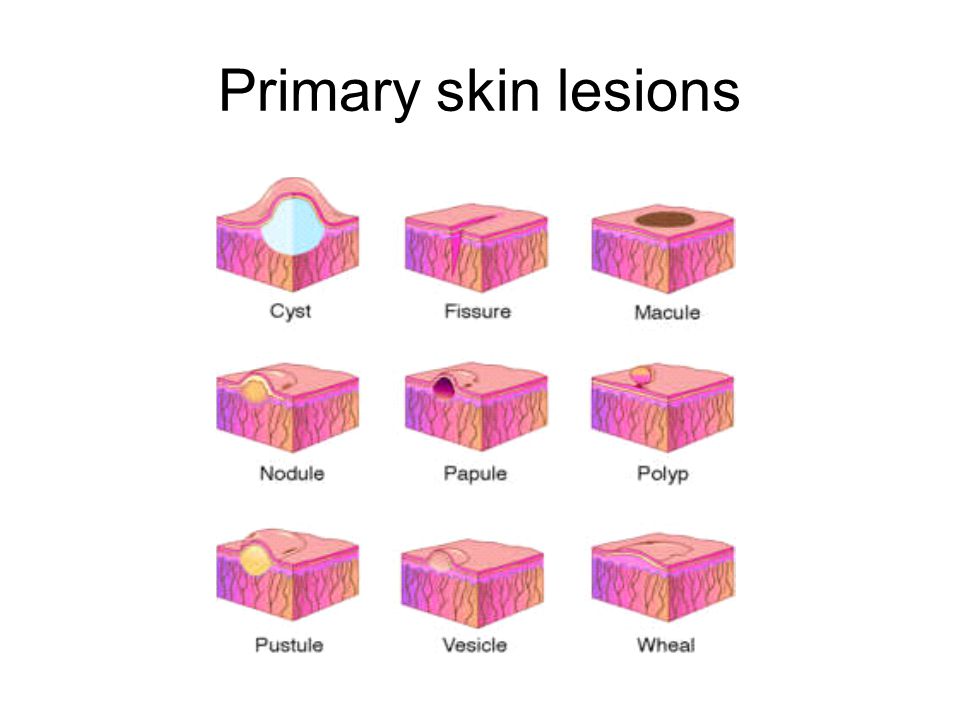 Study Medical Photos: Description Of Primary Skin Lesions