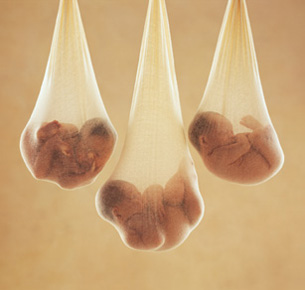 Rus&Les: Fotos de Bebes Anne Geddes Rus&Les: Fotos de Bebes Anne Geddes