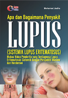 Apa dan Bagaimana Penyakit Lupus ? (Sistemik Lupus Eritematosus)