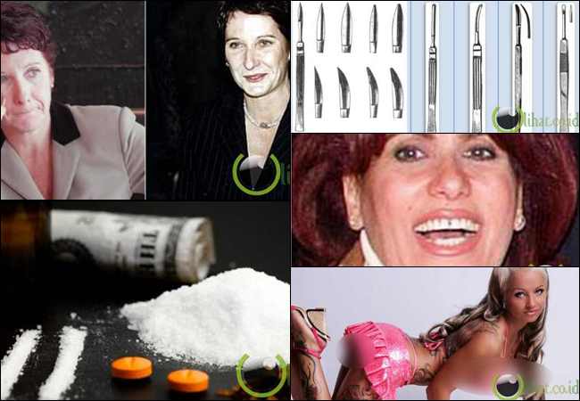 5 Kasus Operasi Plastik Mengerikan yg Berujung Kematian