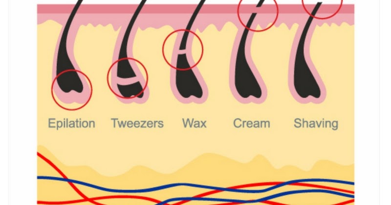Электроэпиляция картинки. Пинцет прозрачный. Красиво выщипать брови. Выдергивание контагиозного моллюска пинцетом. Электроэпиляция картинки.