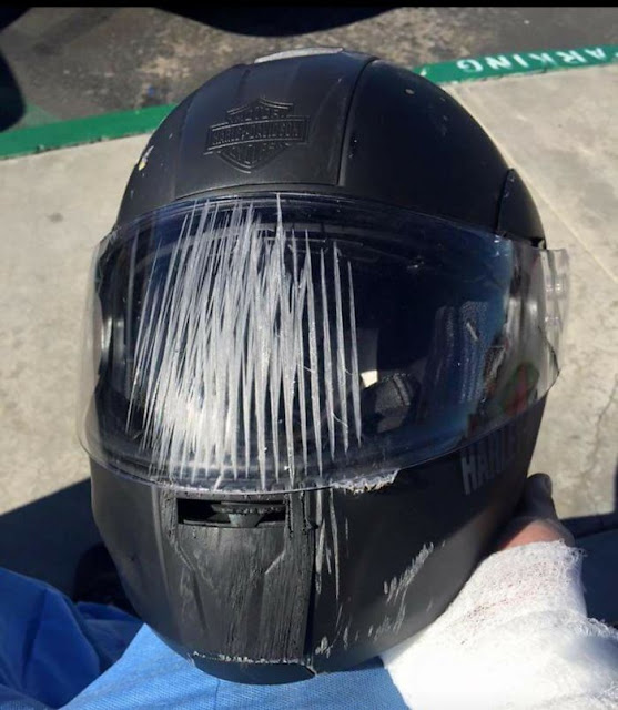 10 Foto Keberuntungan ini Menjadi Bukti Pentingnya Memakai Helm, Agar Tak Selalu Disepelekan 10 Foto Keberuntungan ini Menjadi Bukti Pentingnya Memakai Helm, Agar Tak Selalu Disepelekan