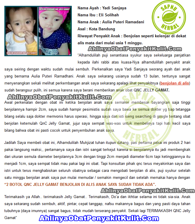 Obat Benjolan Di Daun Telinga ini SANGAT MUJARAB Menyembuhkan Benjolan Di Daun Telinga Obat Benjolan Di Daun Telinga ini SANGAT MUJARAB Menyembuhkan Benjolan Di Daun Telinga