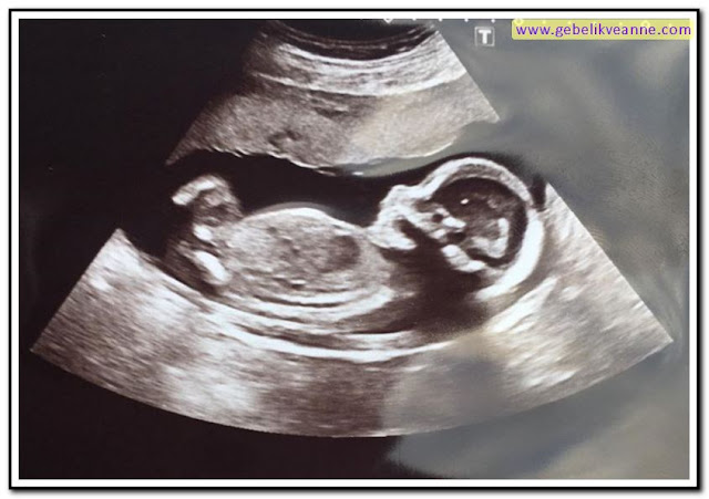 22 haftalık hamilelik ultrason