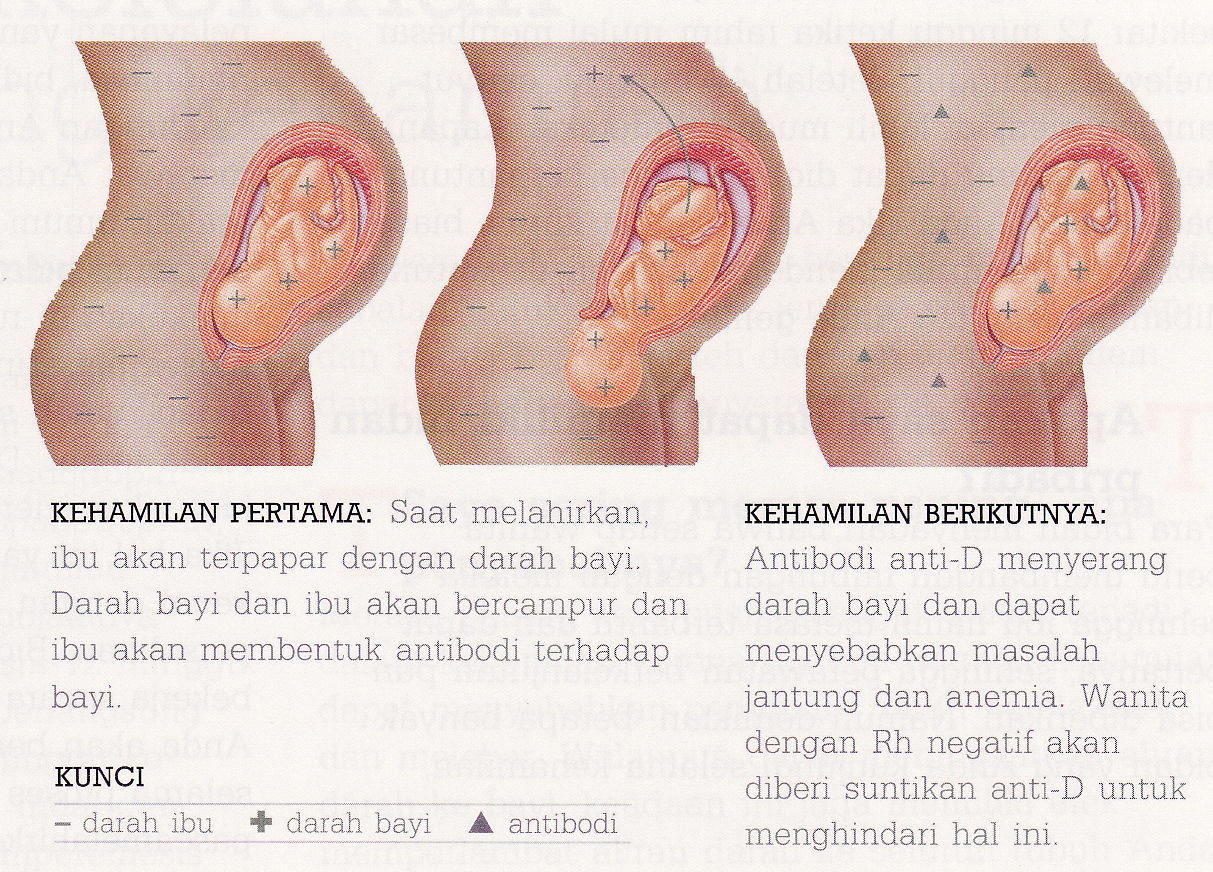 http://2.bp.blogspot.com/-hkaHsazOggc/TZ1syeKpN3I/AAAAAAAAAE0/FzJyhr-fixM/s1600/rhesus+negatif.jpg