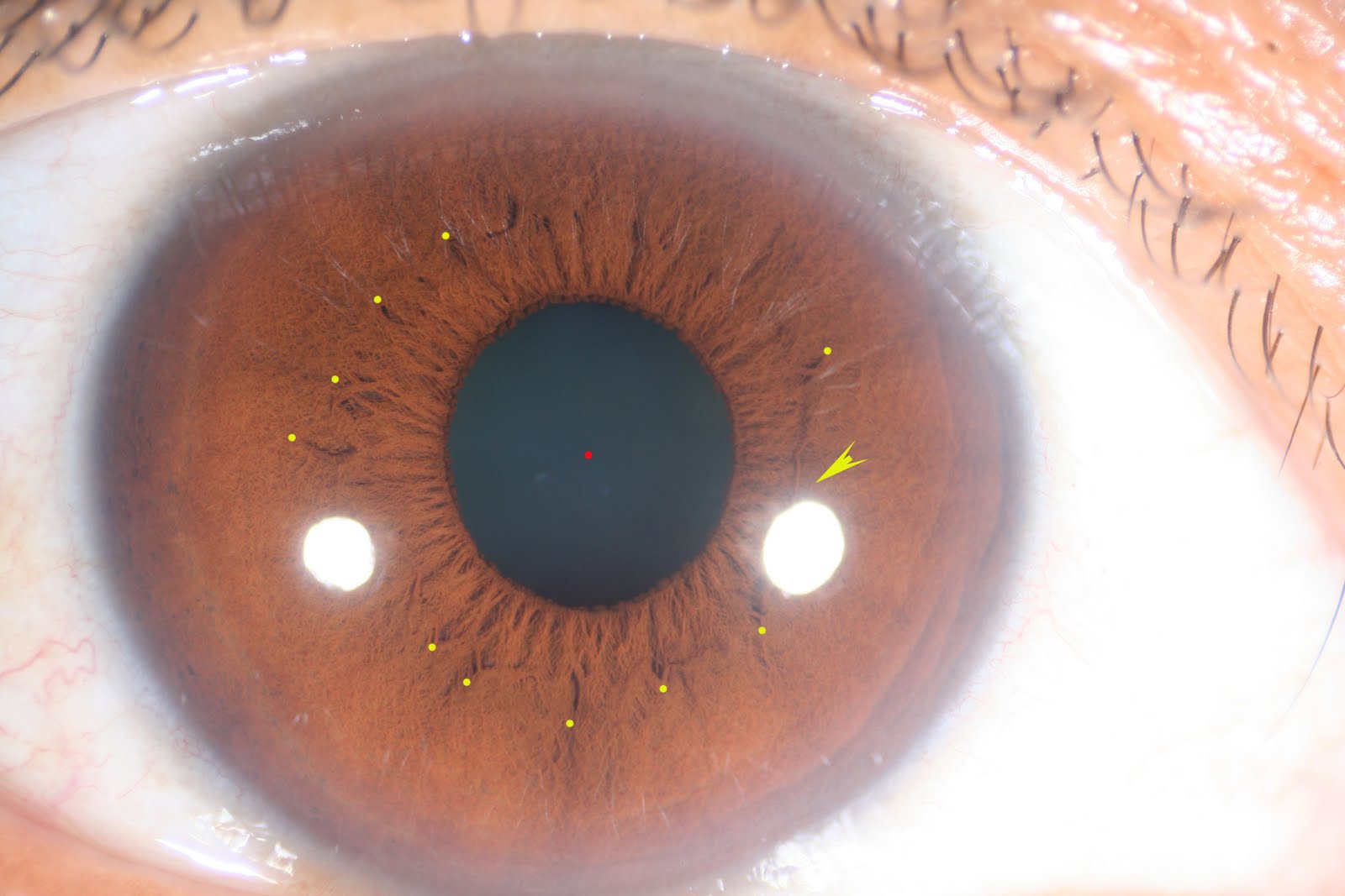 Modern & Multidimensional Iridology Multidimensional Approach of the