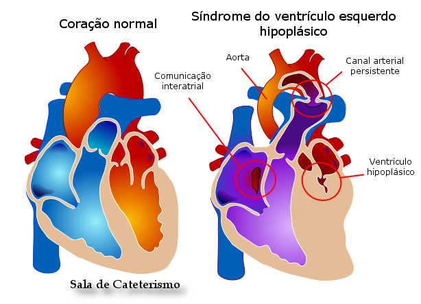 A Sala: Cardiopatias congênitas