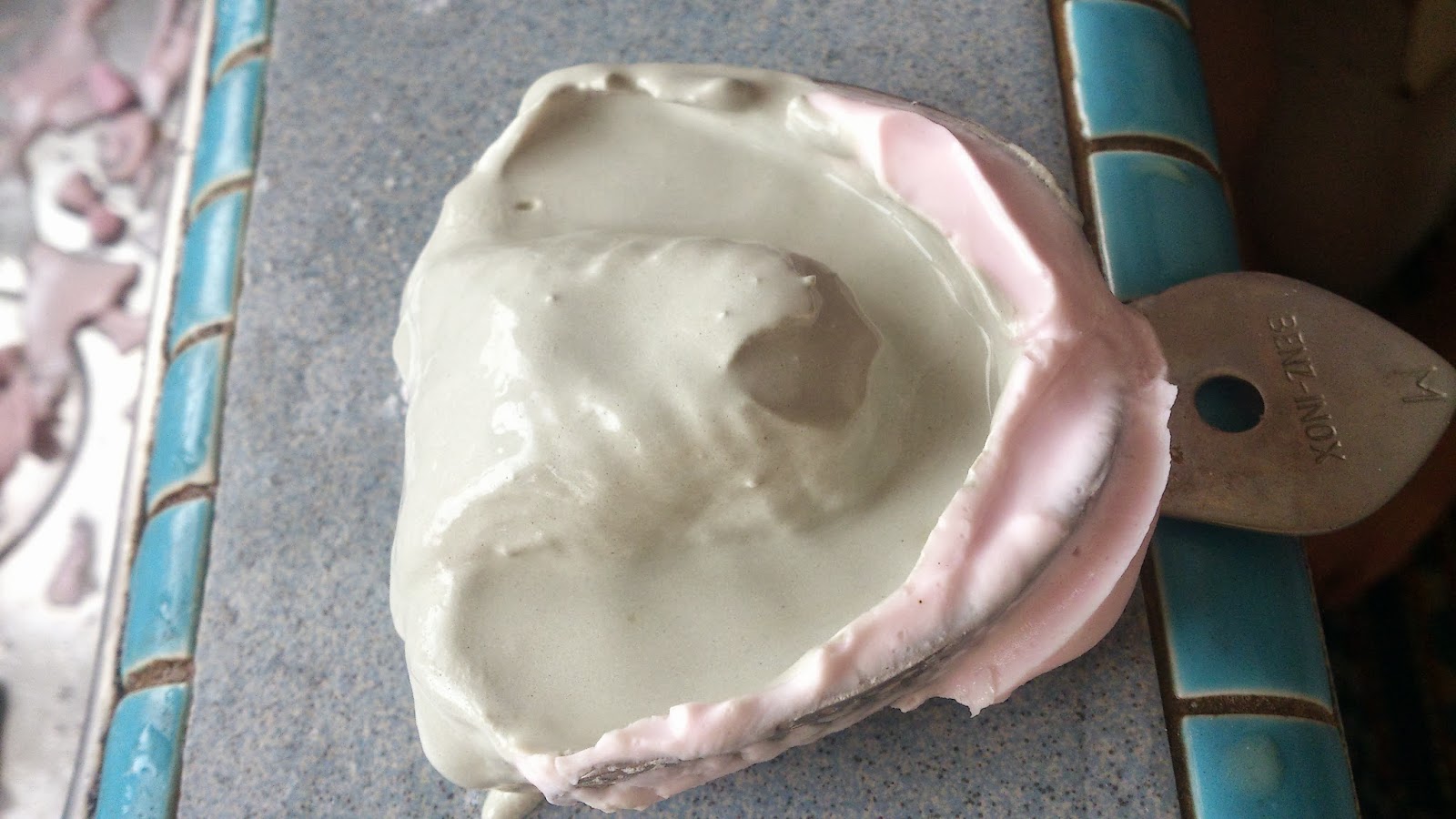 carolechic Orthodontics Retainers Moulding StepbyStep