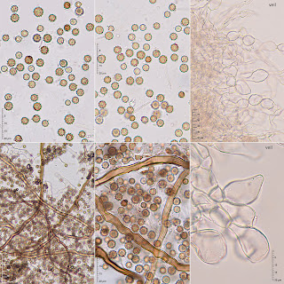 Lycoperdon mammiforme