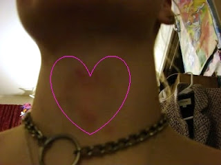 heart shape bruise neck chain necklace collar owned street worker Colfax Denver love model