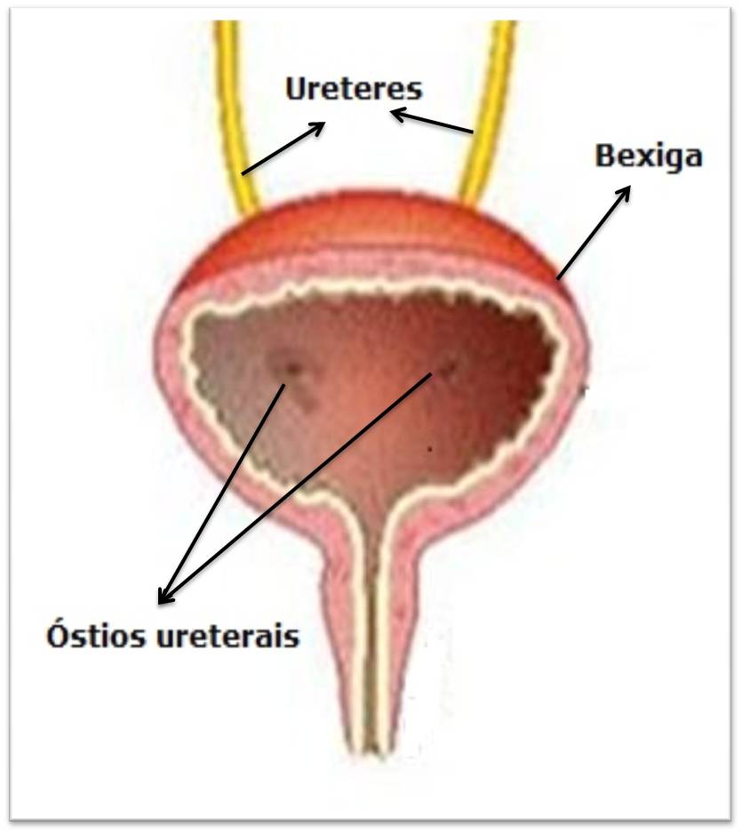 Urologia Pediátrica Os Ureteres Urologia Pediátrica Os Ureteres