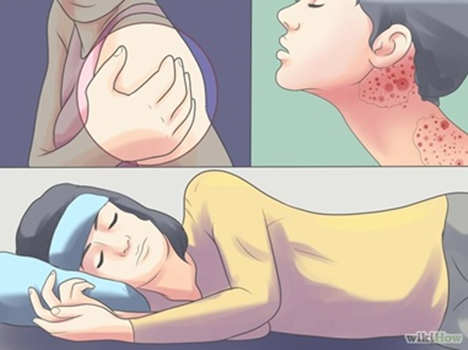 Cara Ampuh Mengobati Demam Chikungunya Cara Ampuh Mengobati Demam Chikungunya