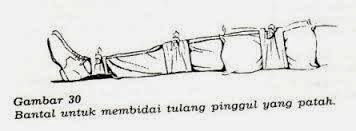 Berbagi Ilmu Dalam Dunia Keperawatan: BIDAI