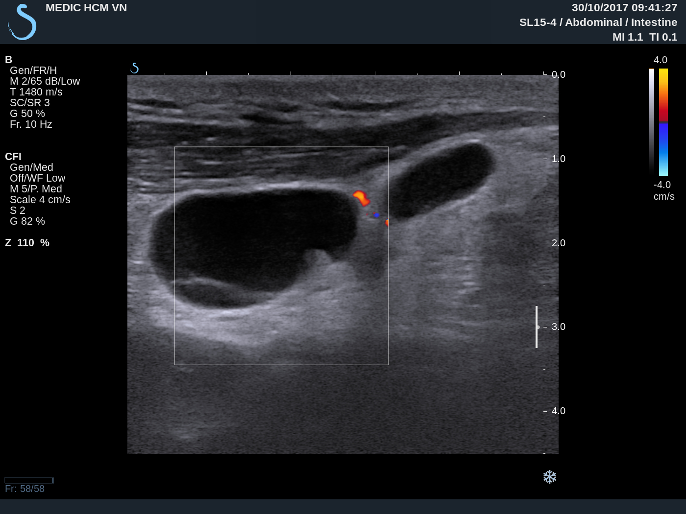 Vietnamese Medic Ultrasound Case 459 Cervical Lymph Nodes Dr Phan