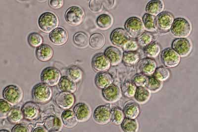 Protista mirip tumbuhan Chlorophyta (ganggang/alga hijau): Chlorella sp.