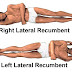 Recumbent position, Dorsal, Lateral, Semi-recumbent position