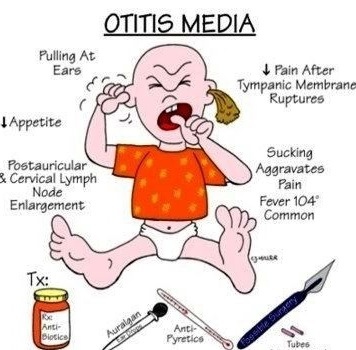 Otitis Media