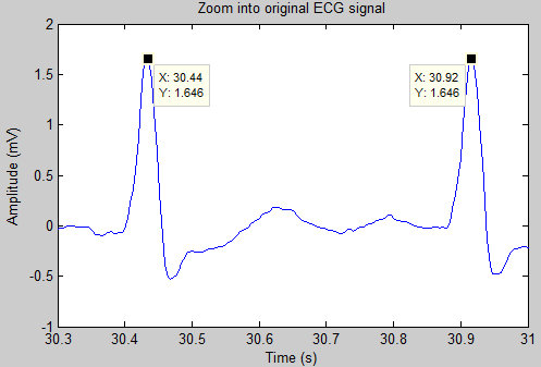 Biomedical Signal and Image Processing projects using Matlab and ...