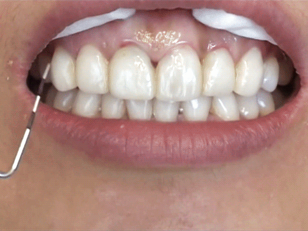 라미네이트(+교체과정).gif | 인스티즈