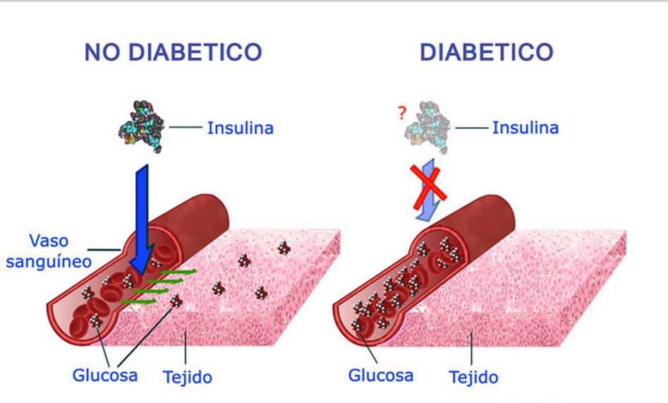 Biología Molecular Diabetes Mellitus