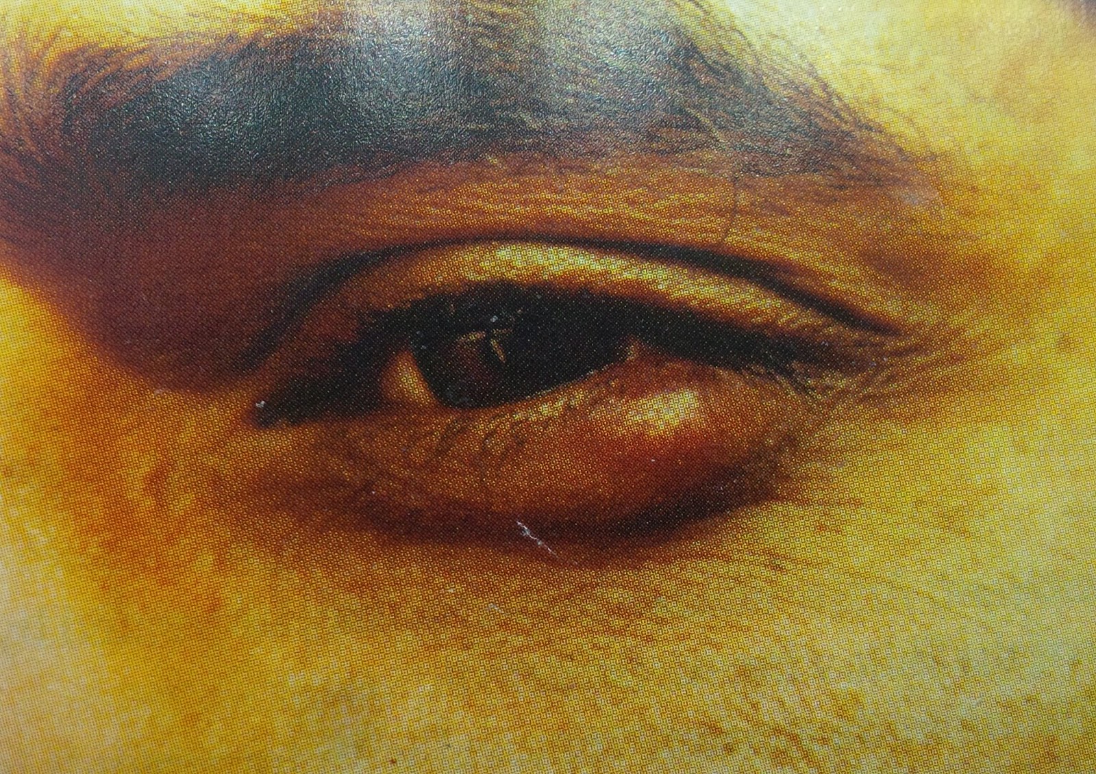 Brief Description, Types, Sign and Symptoms, Causes And Treatment Of