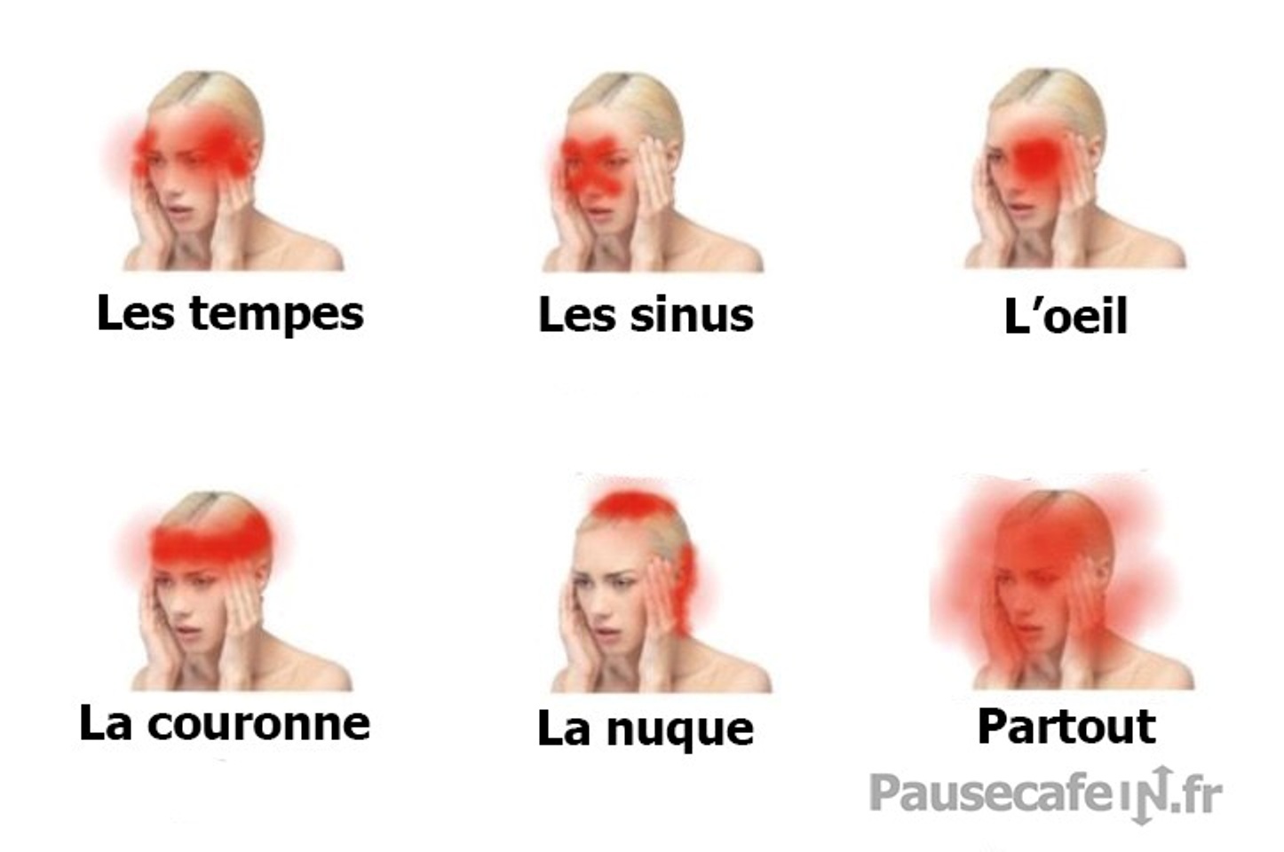 5 types de maux de tête qui peuvent être le signe d
