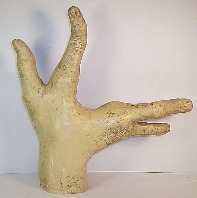 Anonymous Works Lobster Boy Lifecast