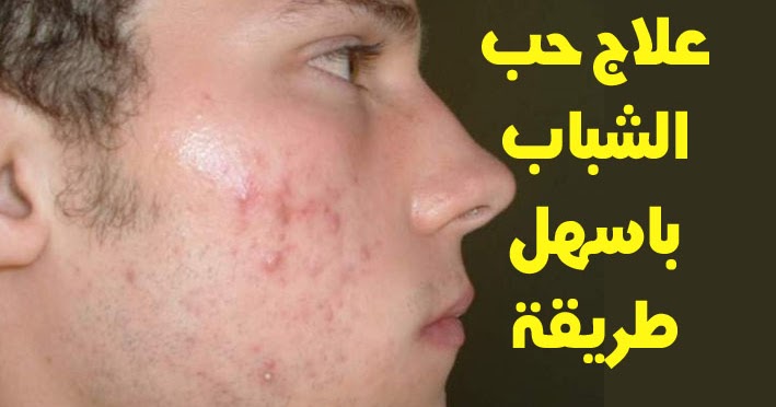 افضل دكتور جلدية بالرياض لعلاج حب الشباب حسب تقييمات الزائرين