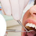 Giải đáp thắc mắc Về tổng mức giá trồng răng implant